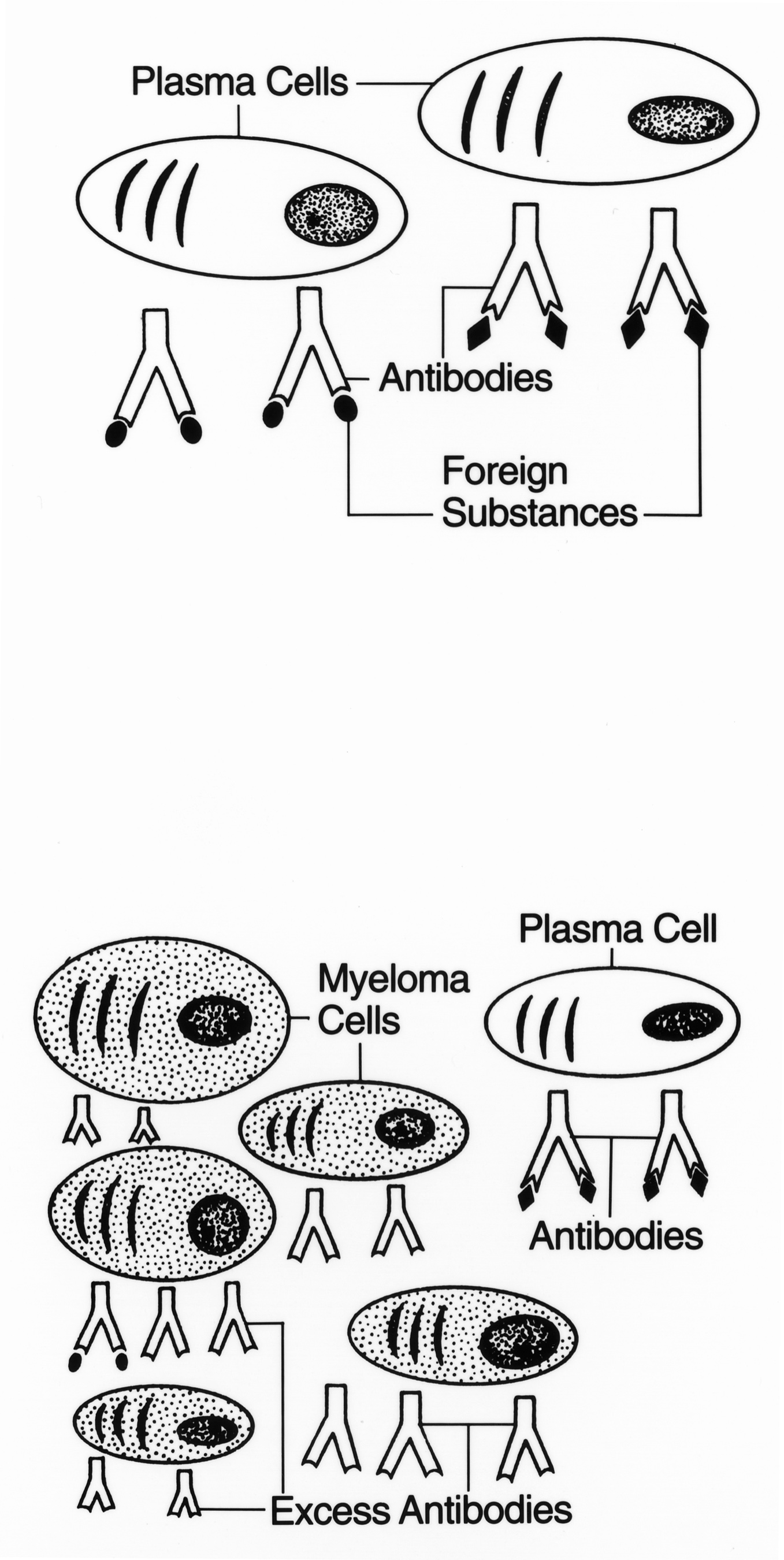 Normal plasma cells producing antibodies (top) versus excess myeloma plasma cells producing unneeded antibodies (bottom). Medical illustration, NCI 1995.