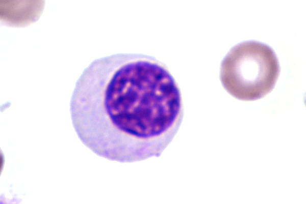 Plasma cell (plasmocyte) micrograph showing eccentric nucleus and basophilic cytoplasm.